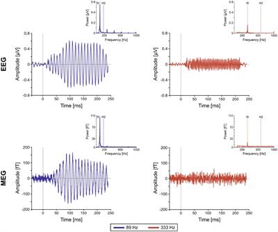 Time-locked auditory cortical responses in the high-gamma band: A window into primary auditory cortex
